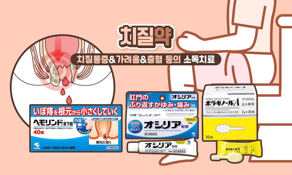 치질 1000x600 1